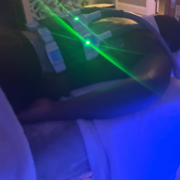 Cryosculpting Machine - Picture 8 of 12